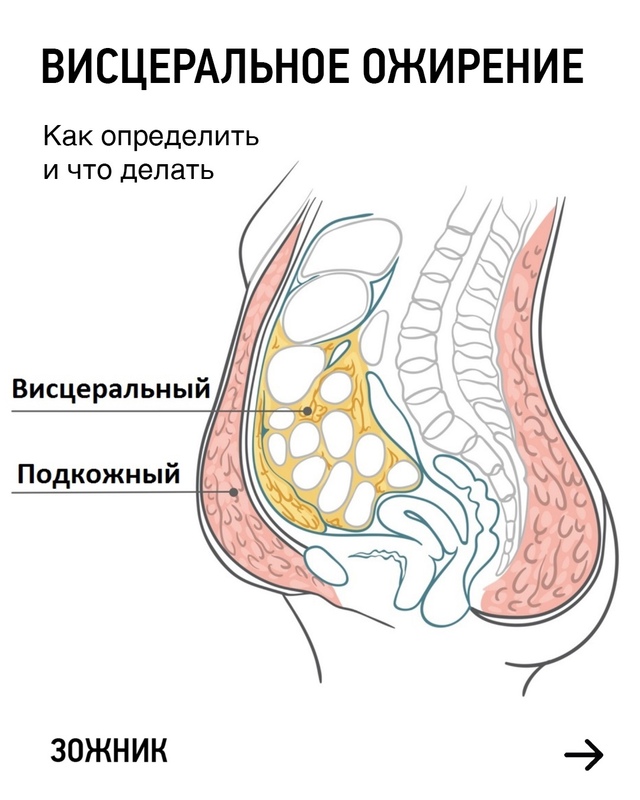 Рассказаваем про висцеральное ожирение, про формулу (н...