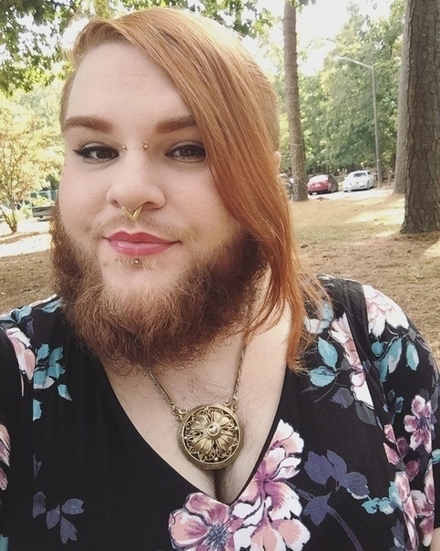 26-летняя Нова Галаксия страдает от поликистозного син?...