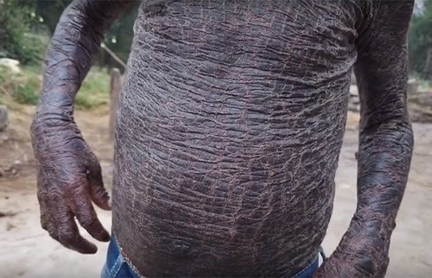 В индийском штате Орисса проживает мальчик по имени Дж...