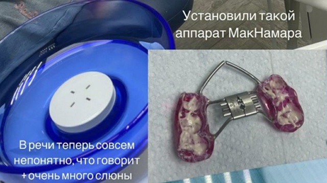 Добрый день, уважаемые специалисты! Подскажите, пожалу...