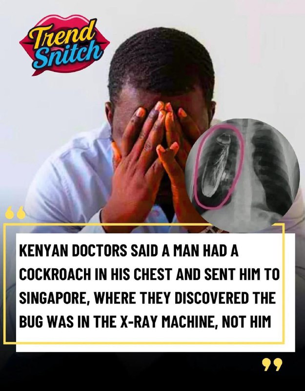 В Кении врачи заподозрили у мужчины таракана в груди и срочно отправили его в Сингапур — там выяснил