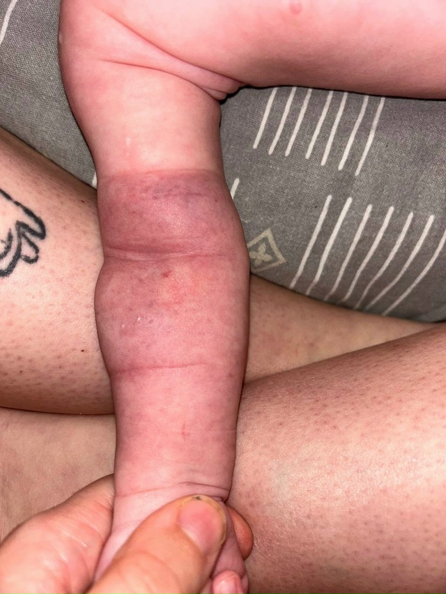 В детской поликлинике работают живодеры! Малышу 2х мес?...