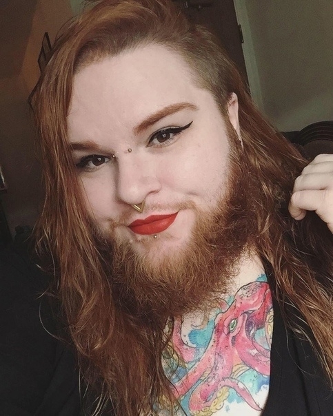 26-летняя Нова Галаксия страдает от поликистозного син?...