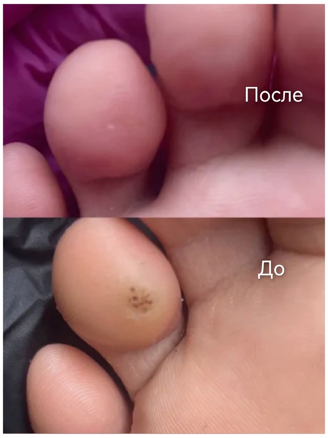 Специалист-подолог приглашает жителей Акбулака и близ...