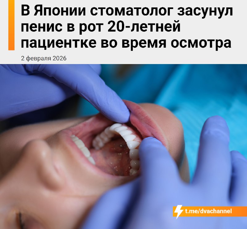 Стоматолог засунул член в рот пациентке прямо во время лечения
Дикий случай произошёл в Японии: вра