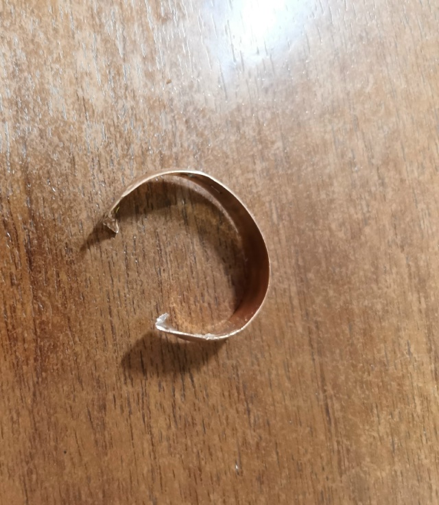 В Кунгуре спасатели помогли снять кольцо с опухшего па...