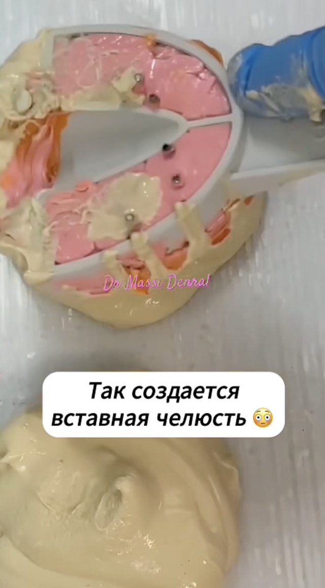 Не самое приятное занятие