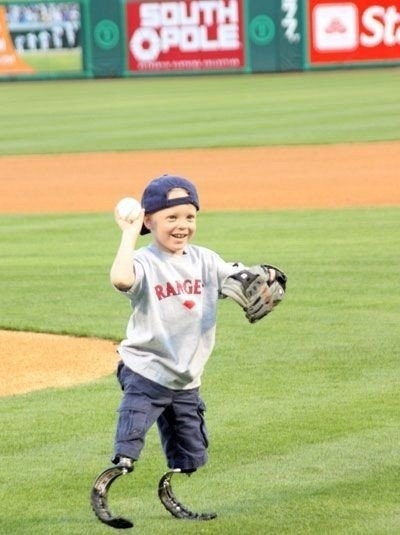 У Коди МакКасланда редкое заболевание - разновидность ...