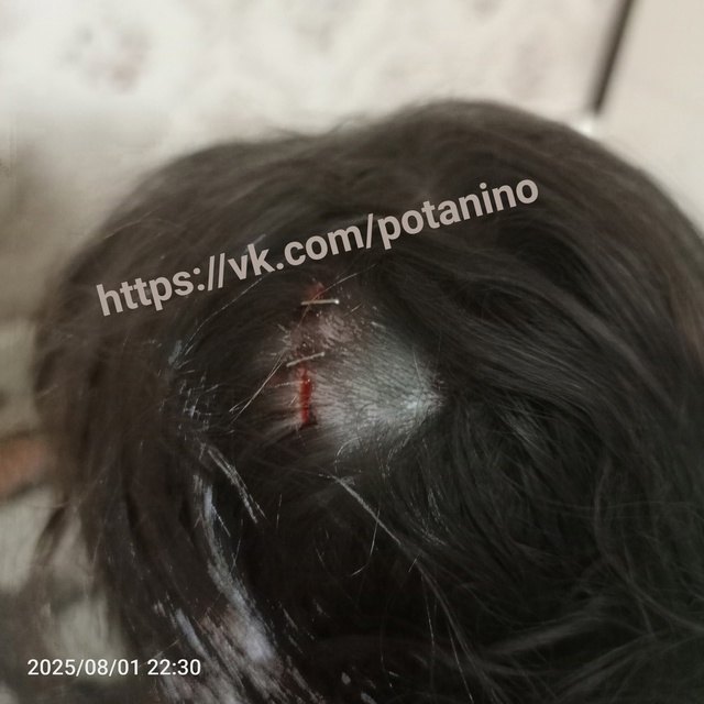 😱В КОПЕЙСКЕ РЕБЁНКУ НА ГОЛОВУ УПАЛ КУСОК ШИФЕРА
В пос...