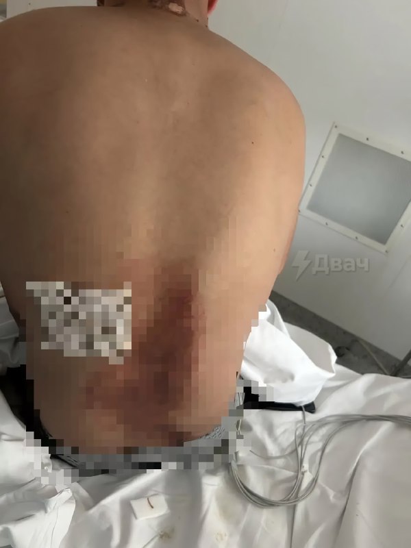 На Алтае морской пехотинец, приехавший домой в отпуск, выжил после удара молнии и встречи с медведем