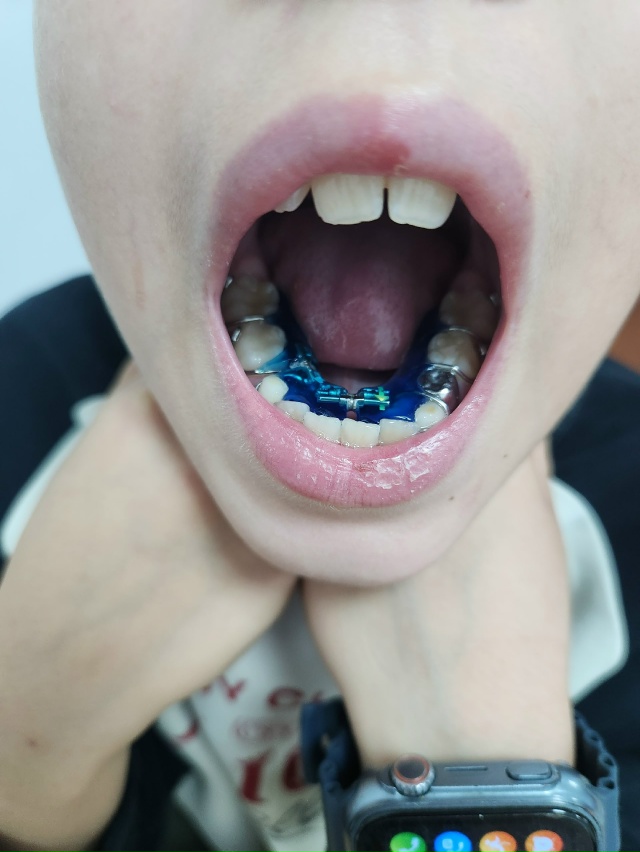 Анонимно пожалуйста. Здравствуйте,уважаемые коллеги! ...