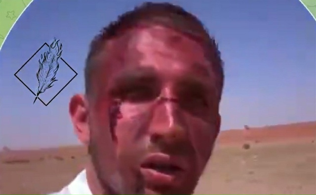 🔥 СРОЧНО! Михаила Литвина избили в центре Москвы! 🔥 ?...