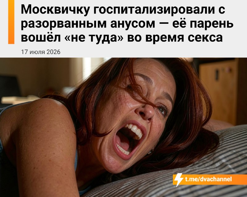 Москвичку госпитализировали с порванным анусом — парень ошибся входом во время секса
В Москве 20-ле