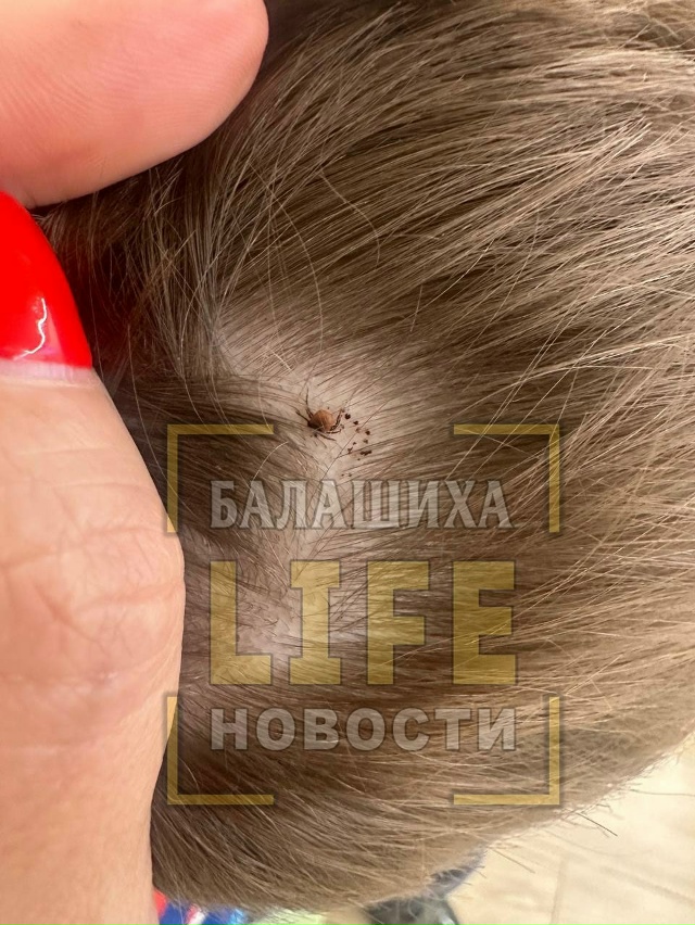 Сын поймал клеща или клещ сына. Возможно в парке Пехорк...