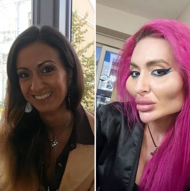 ? В Госдуме заговорили о полном запрете пластических ...