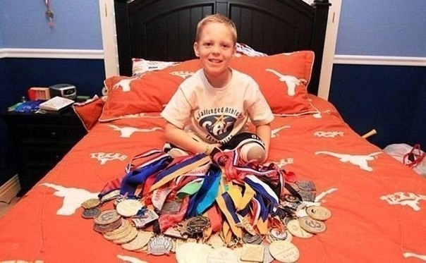 У Коди МакКасланда редкое заболевание - разновидность ...