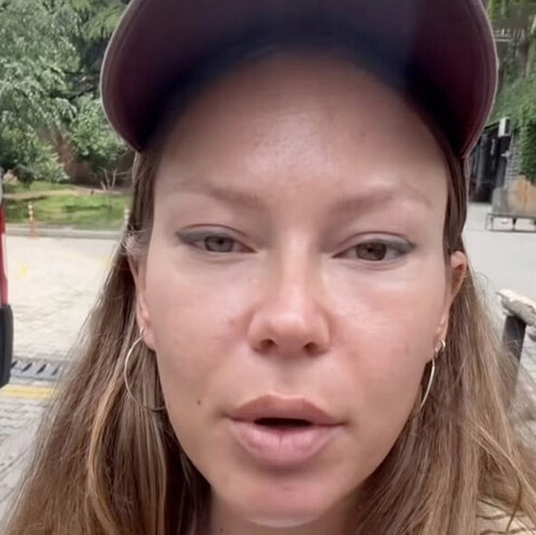 «У меня дыра в щеке»: Рита Дакота призналась, почему ей ...
