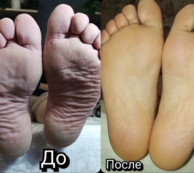 Специалист-подолог приглашает жителей Акбулака и близ...