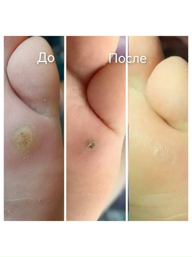 Специалист-подолог приглашает жителей Акбулака и близ...