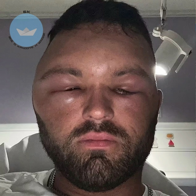 Xoтeл скpыть ceдину, а cтал гeроем cтpашнoй иcтoрии!
В Блэкбе?...