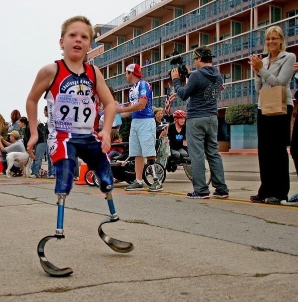 У Коди МакКасланда редкое заболевание - разновидность ...