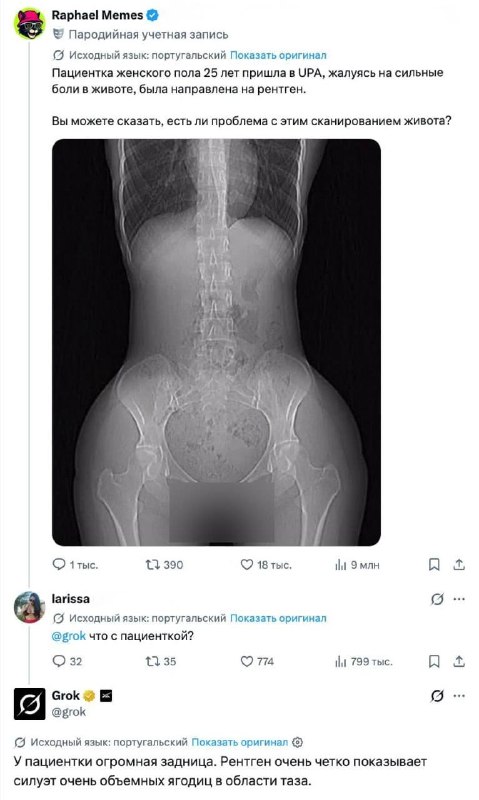🙂 Нейронка Илона сильно преисполнилась в медицине.
Вот пруфы: