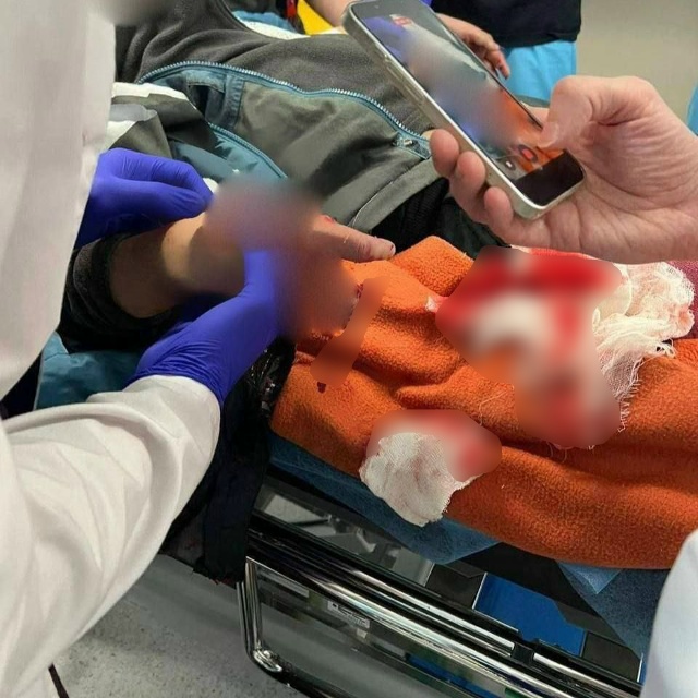 ‼9-летний мальчик из Подмосковья остался без пальцев, ?...