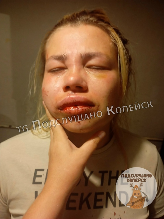 ❗⚡СРОЧНО, КОПЕЙСК
🤬Сегодня ночью во дворе Гольца 16 п?...