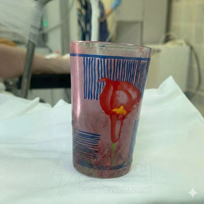 ❗️В Уфе мужик на 23 февраля умудрился засунуть себе стакан в задницу: сам он говорит, что просто пос