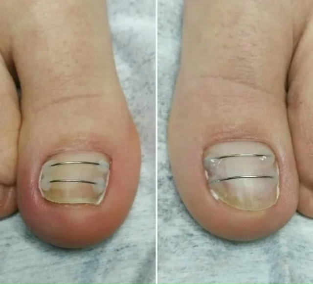 Специалист-подолог приглашает жителей Акбулака и близ...