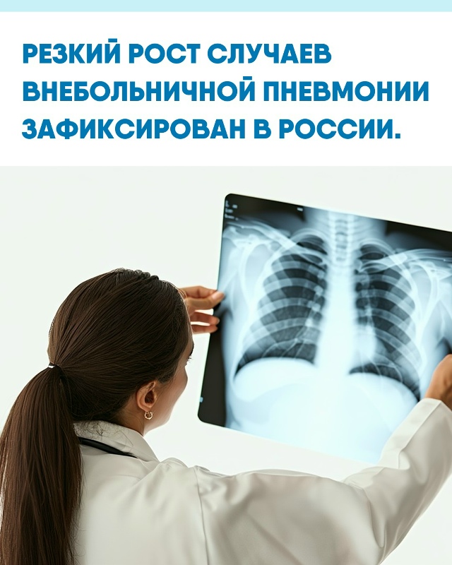 Минздрав сообщает о заметном увеличении числа тяжёлых...