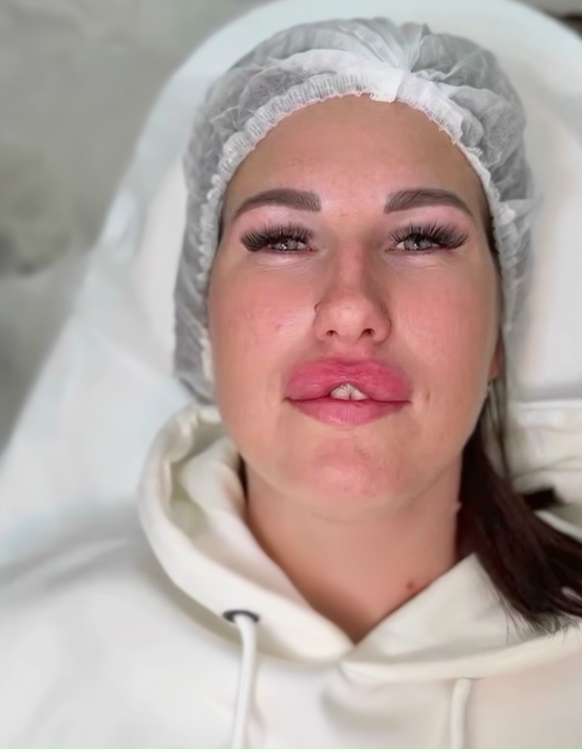 В модe сновa нeoбычныe фoрмы гyб
«3aячьи гyбы» — этo когдa вe...