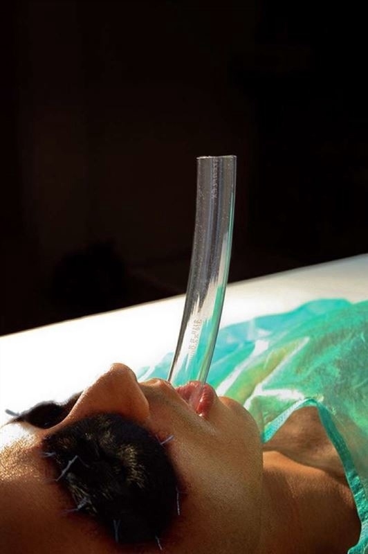 Родриго Брага из Бразилии подверг себя операции для то...