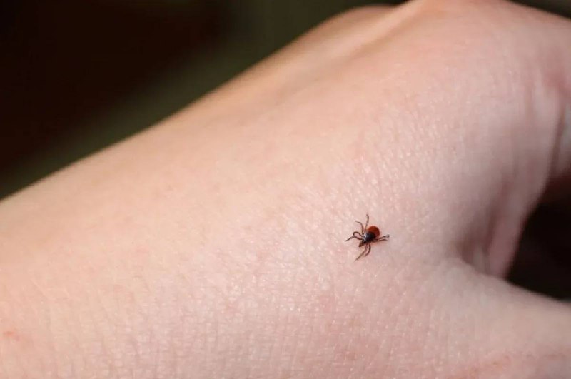 🕷️ 10 000 случаев укусов клещей зафиксировано в Подмосковье с начала сезона, — Роспотребнадзор
Случ