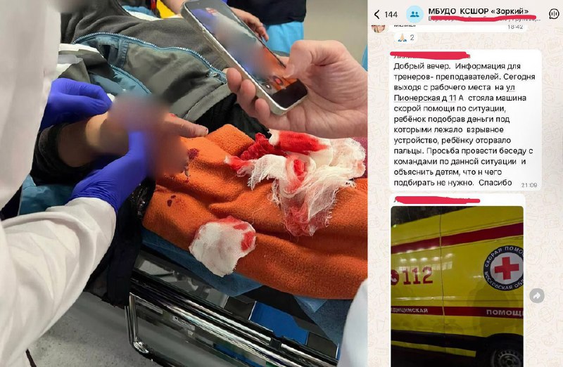 ‼️9-летний россиянин поднял с земли свёрток с деньгами, а он взорвался: ребёнок тяжело ранен, ему от