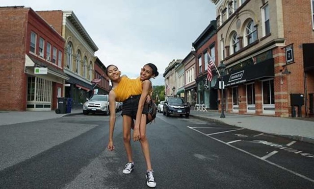 В США сестры - сиамские близнецы, 18-летние Кармен и Лупи...