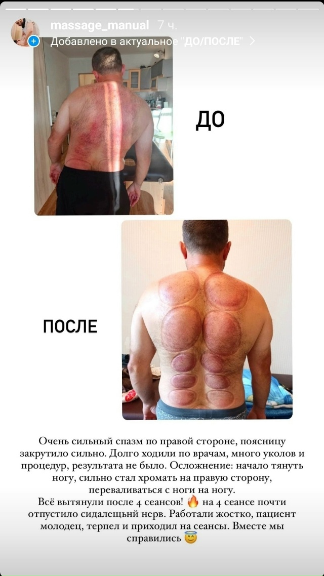 🚑 ЕКАТЕРИНБУРГ 🚑
Открыта запись на приëм к мануально...