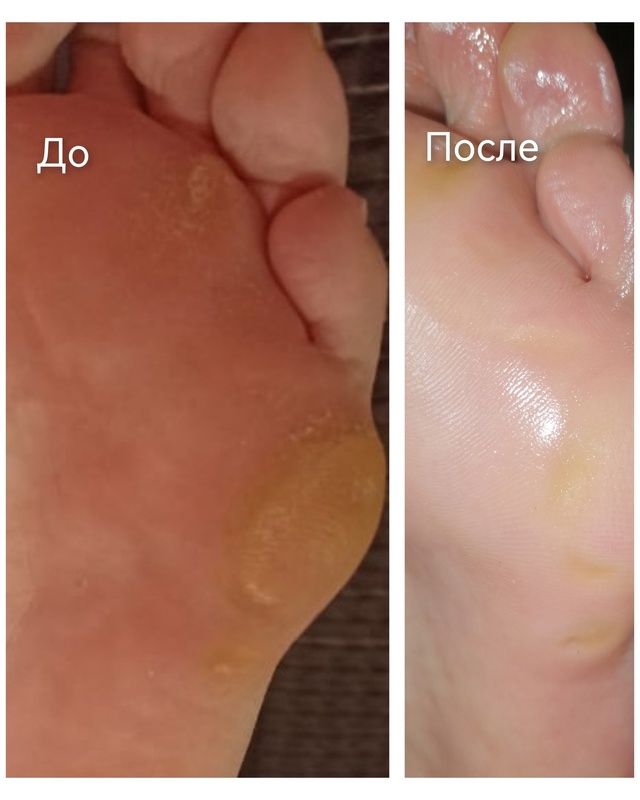 Специалист-подолог приглашает жителей Акбулака и близ...