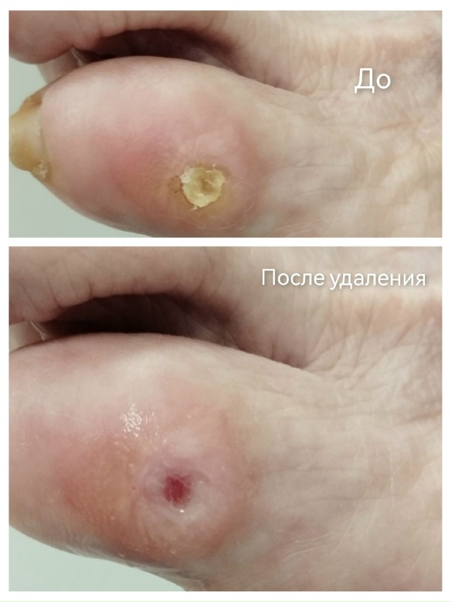 Специалист-подолог приглашает жителей Акбулака и близ...