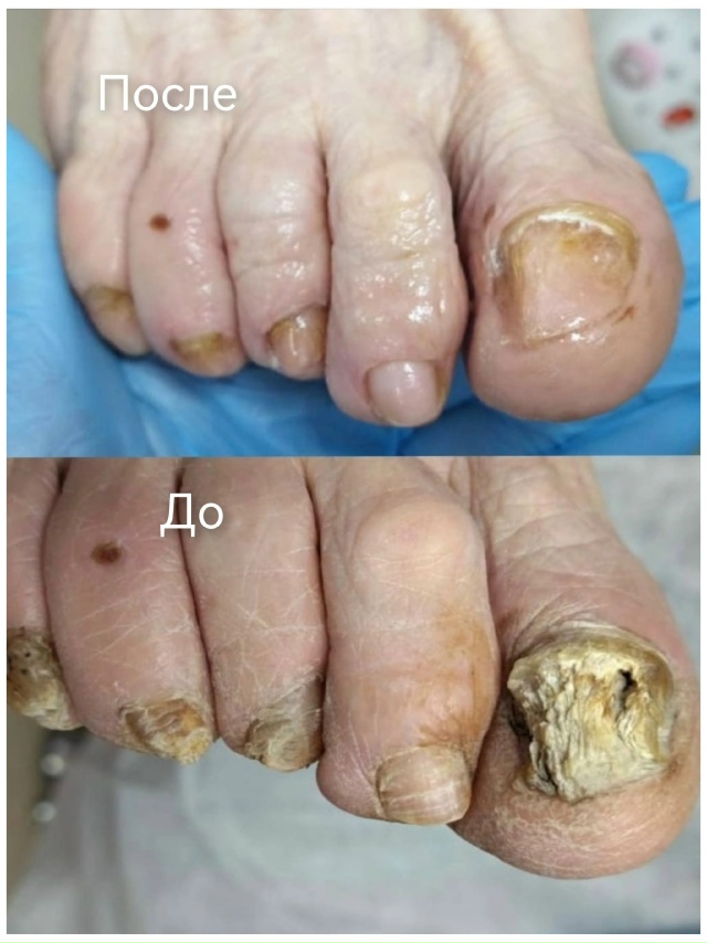 Специалист-подолог приглашает жителей Акбулака и близ...