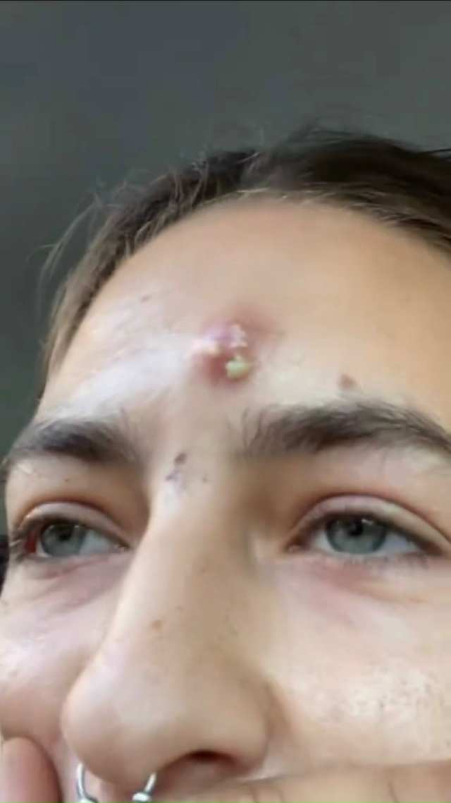 Подскажите, что это за хр@нотень у моей бывшей ВЫЛЕЗЛА??...