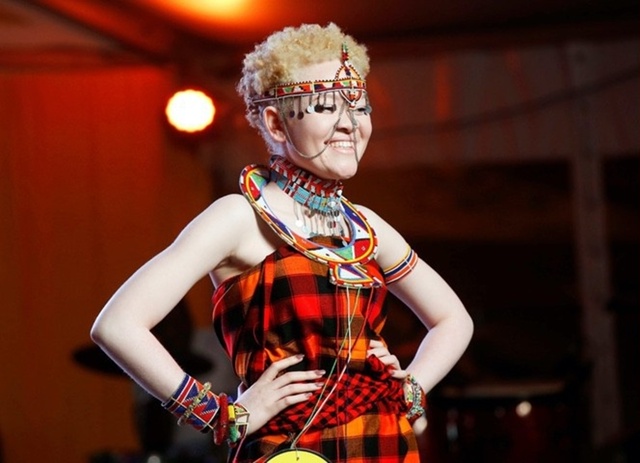 Оорганизация Albinism Society of Kenya, которая спасает альбиносо...