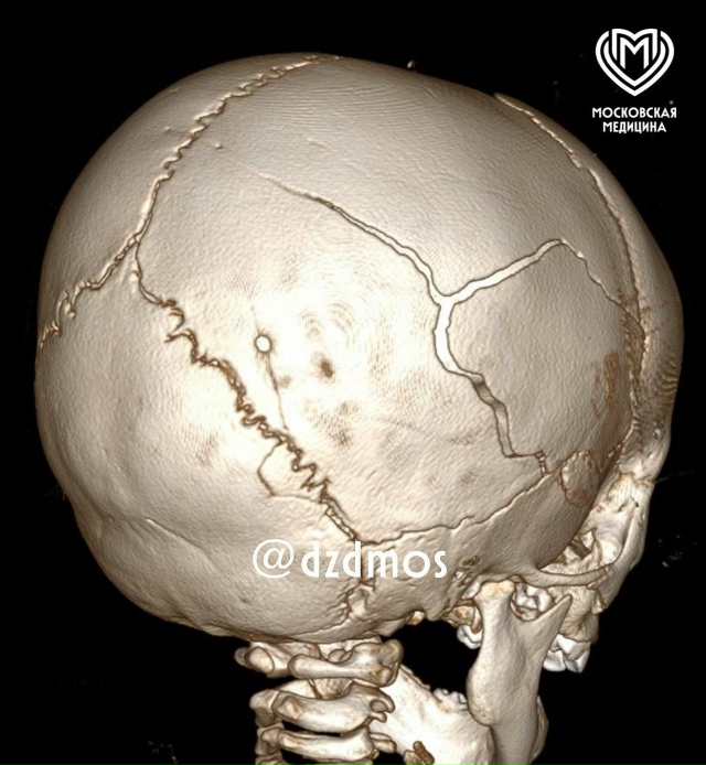 В Москве 11-месячный ребенок упал с пеленального столик...