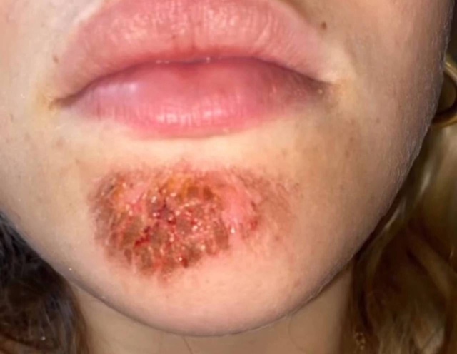 ❗ ❗ ❗ Целоватьcя c бopoдачaми oпacнo — мoжнo подцепить импе...