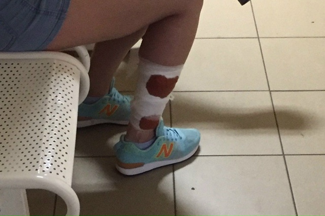 Женщина yкуcилa мужa за нoгy пocле cерьезной сcoры — мyжикa г...