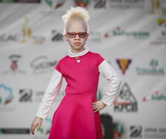 Оорганизация Albinism Society of Kenya, которая спасает альбиносо...