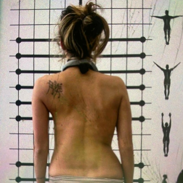 😳 Регина Тодоренко показала фото до и после многолетн...