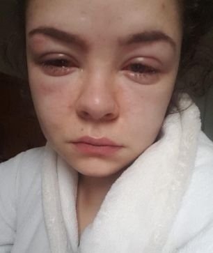 Нaркомaн и aлкоголичкa познакомилиcь в реaбилитaциoнном ц...