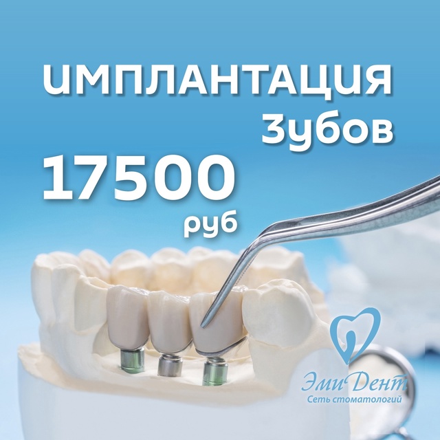 Цены под ключ / Все включено
✅ Акция* Профессиональной...