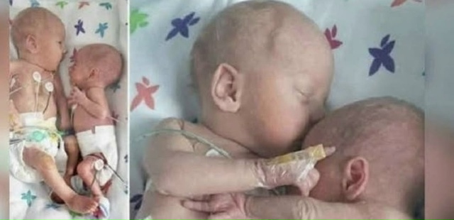 Медсестра положила здорового ребёнка рядом
с его умир...